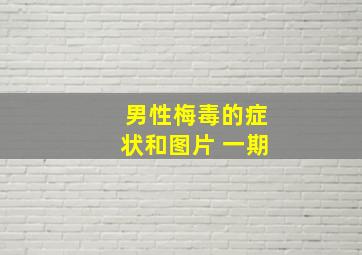 男性梅毒的症状和图片 一期